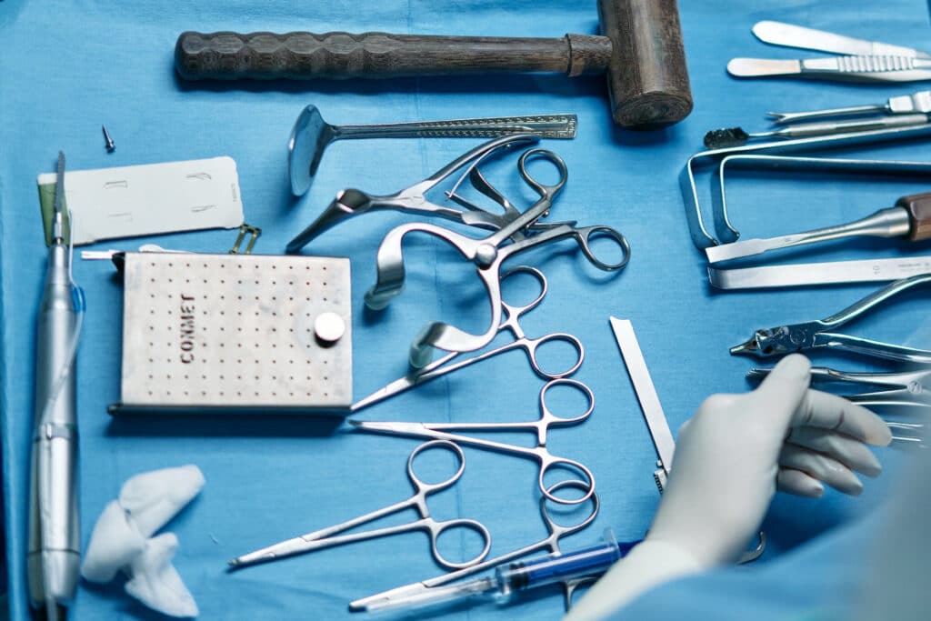 hysterectomy