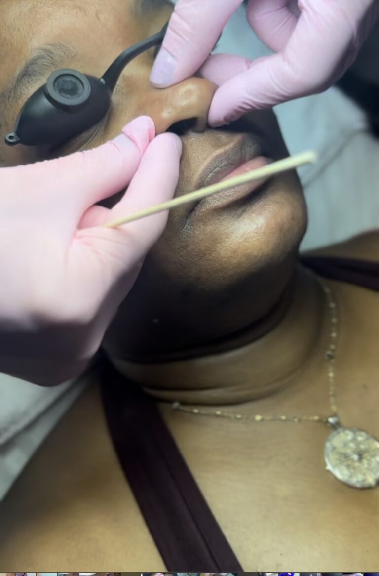 Deluxe Hydrafacial at Body + Beauty Lab in Radnor